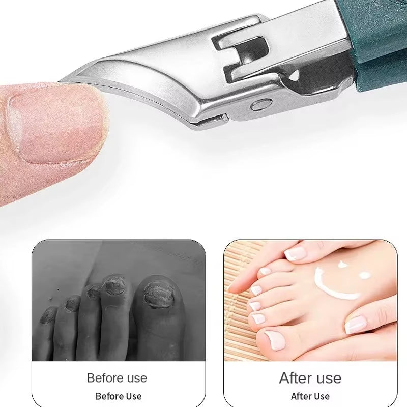 25° Slant Edge Nail Clipper Set Anti-Splash Eagle Beak Oblique Toe Nail Trimmers for Ingrown Toenail Professional Manicure Tools